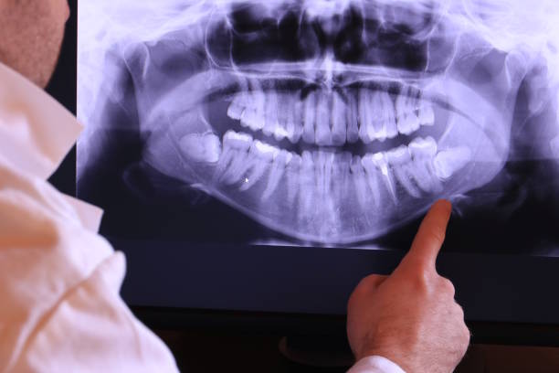 Best Pediatric Emergency Dentist in Union City, TN