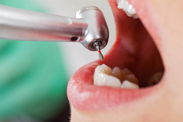 Best Weekend Emergency Dentist in Union City, TN